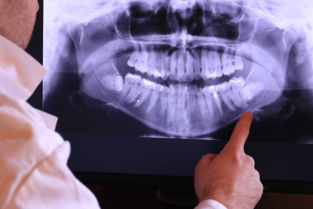 Best Emergency Treatment for Dental Infections or Abscesses in Cashton, WI