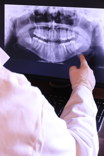 Best Emergency Root Canal Treatment in Cashton, WI