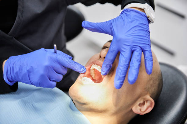 Best Emergency Root Canal Treatment in Cashton, WI